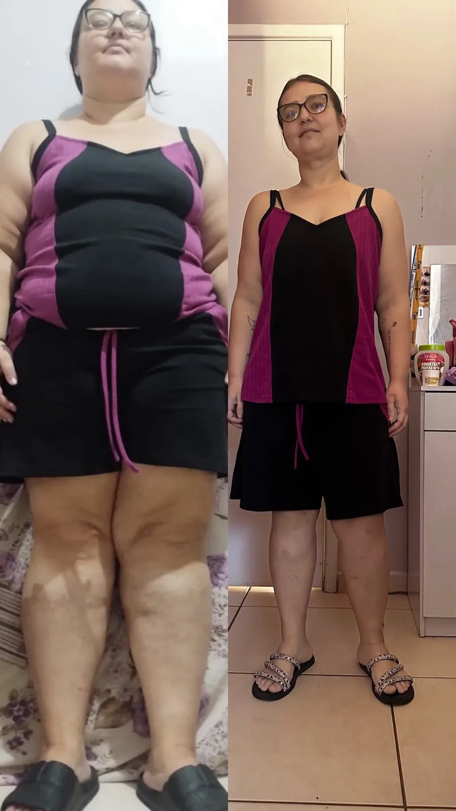 Antes e depois de aluno do Gabriellus Team